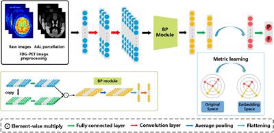 BMNet: A New Region-Based Metric Learning Method for Early Alzheimer’s Disease Identification With FDG-PET Images